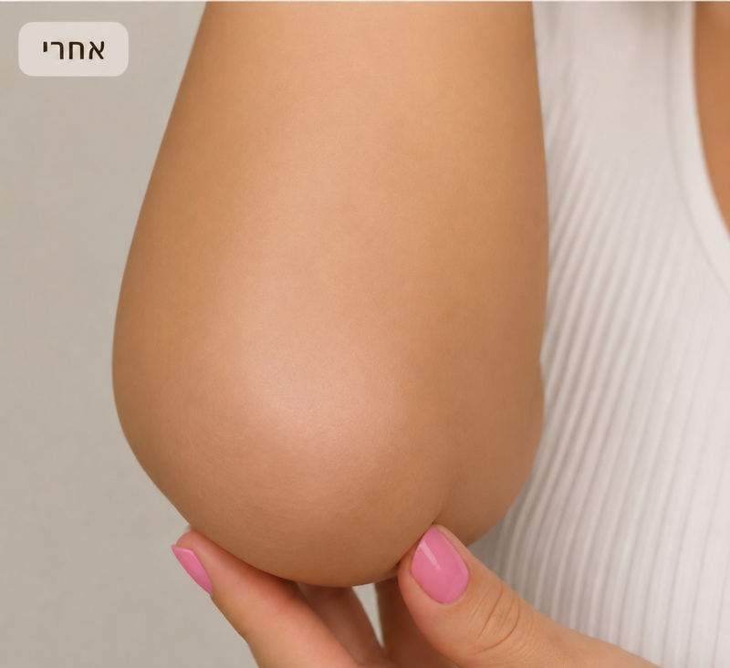 מראה העור לאחר שימוש עקבי ב־Virelle